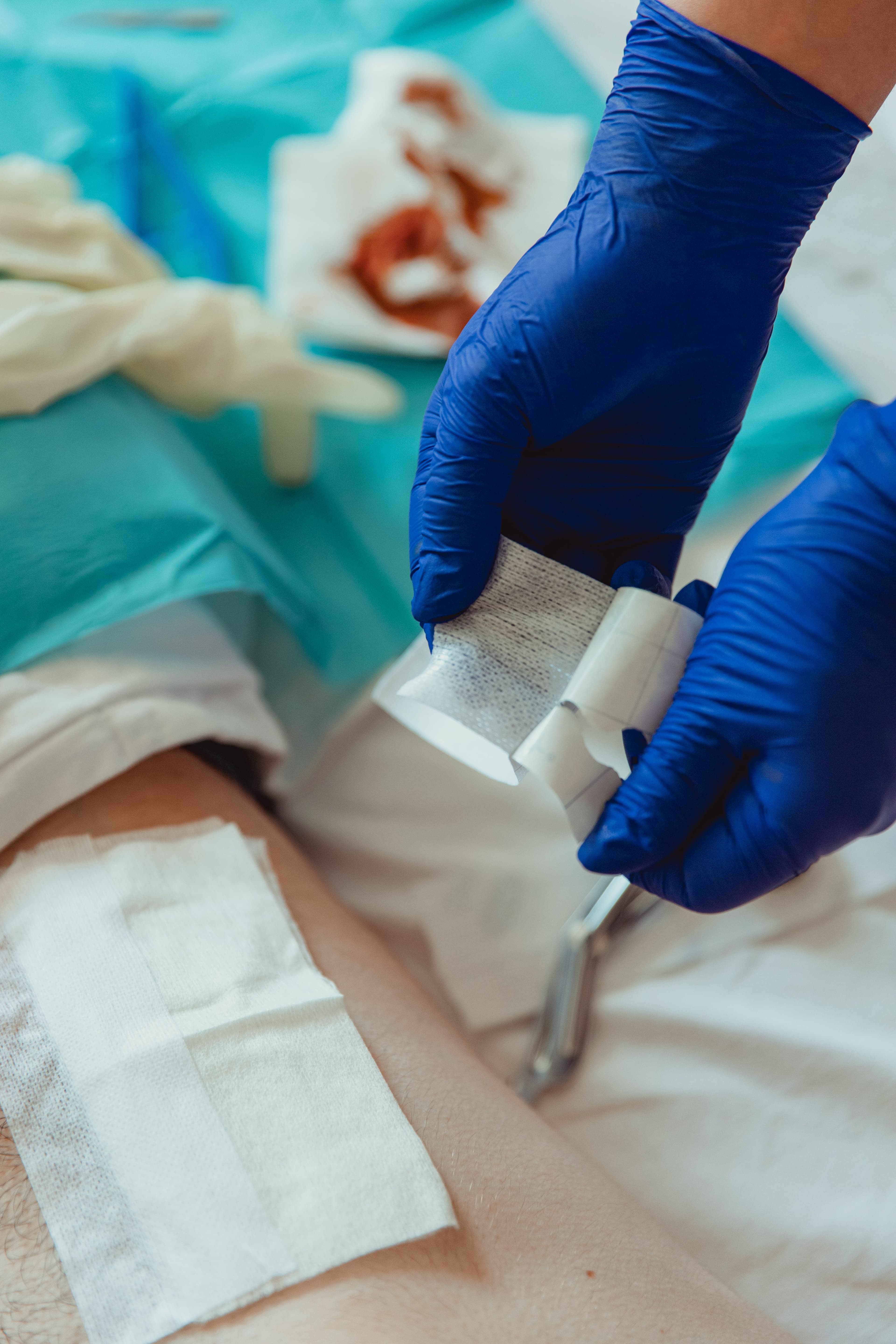 Recuperarea post-operatorie la domiciliu: Beneficii și Manopere Esențiale